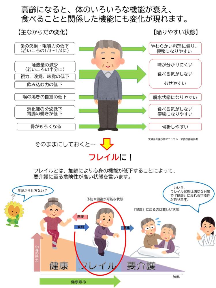 フレイル予防いろいろな機能衰え